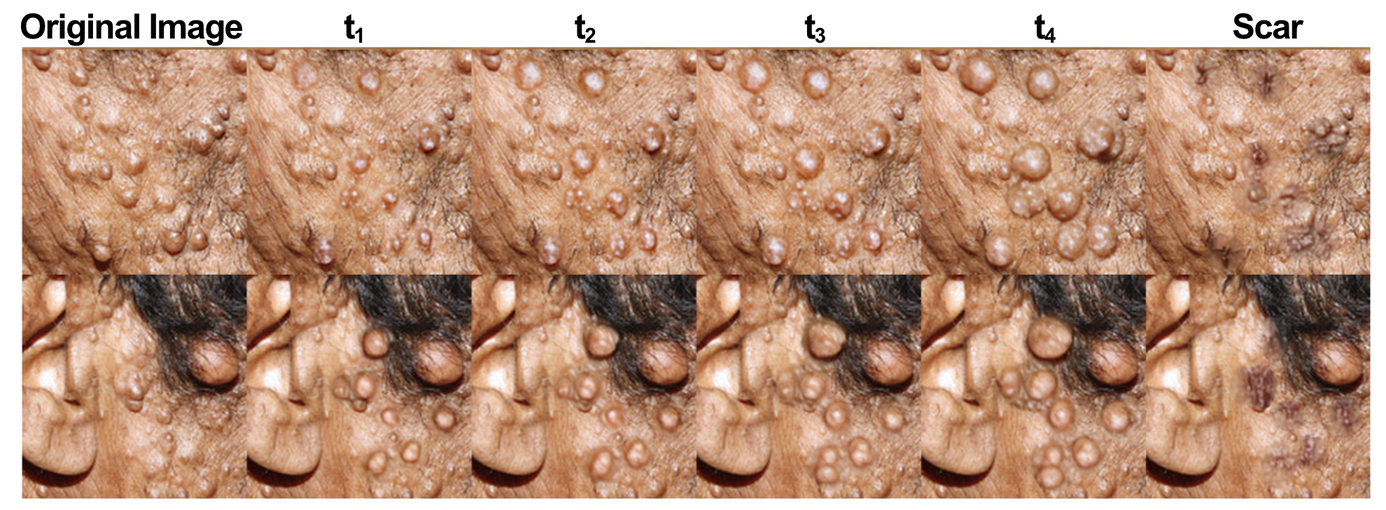 An original cNF image followed by four simulated growth stages and a simulated scar